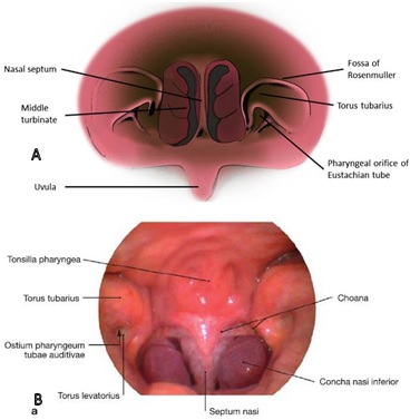 Nasopharynx from looks anterior. 14,15 A. illustration, B . picture endoscopy