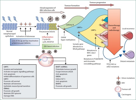 Infection EBV And Change Genomics in Development of Nasopharyngeal Carcinoma