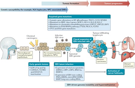 Illustration of the Hypothesis of Nasopharyngeal Carcinoma Pathogenesis. 7 Exposure carcinogen from environment can induce various lesi genetics which then becomes a predisposition for EBV infection. EBV infection triggers dysplastic lesions that eventually develop into nasopharyngeal carcinoma