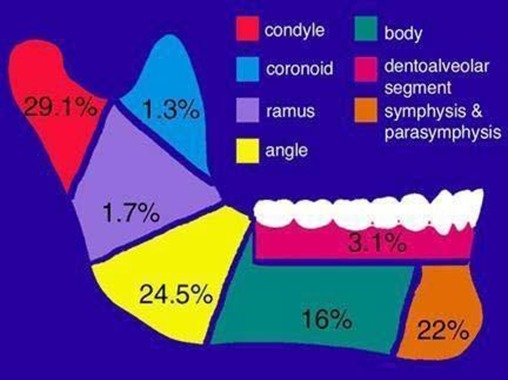 Picture 7. Region mandible And frequency fracture mandible based on region 3