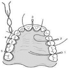 Picture 12. Technique eyelet or ivy loop.9