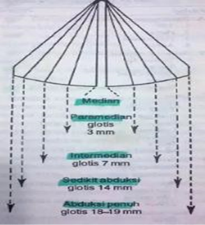 Picture 7. Position Tape Voice 4