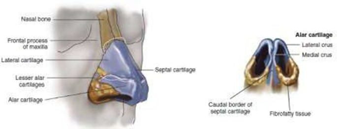 Picture 2 . Osteocartilaginous on nose.