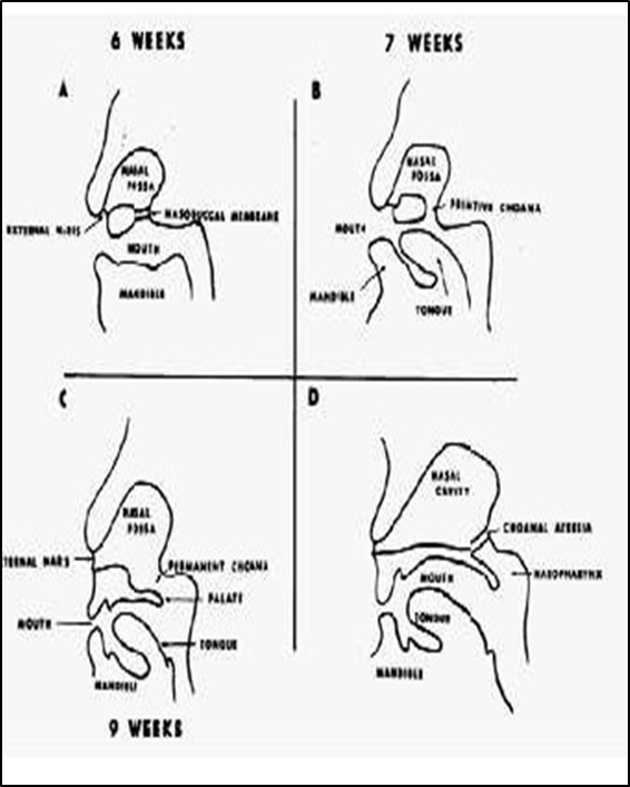 Picture 4. Process occurrence of atresia koana.5